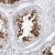 Immunohistochemistry-Paraffin: ADAM2 Antibody [NBP1-85416] Immunohistochemical staining of human testis shows strong cytoplasmic positivity in spermatocytes.